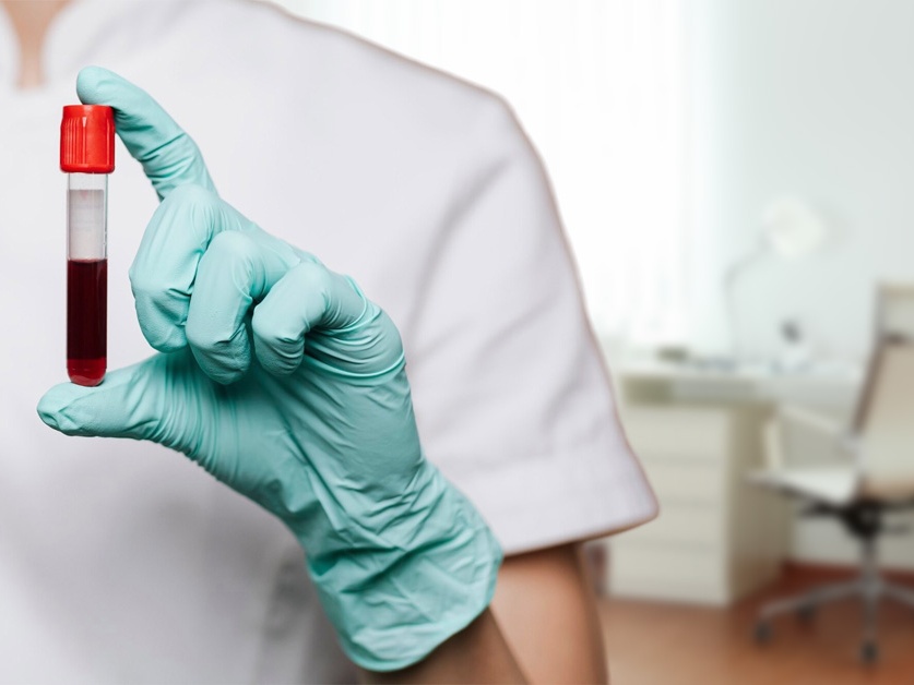 Hematologická ambulance - Rokycanská nemocnice