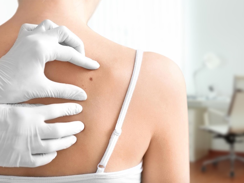 Kožní ambulance - MUDr. Ivana Hrubá